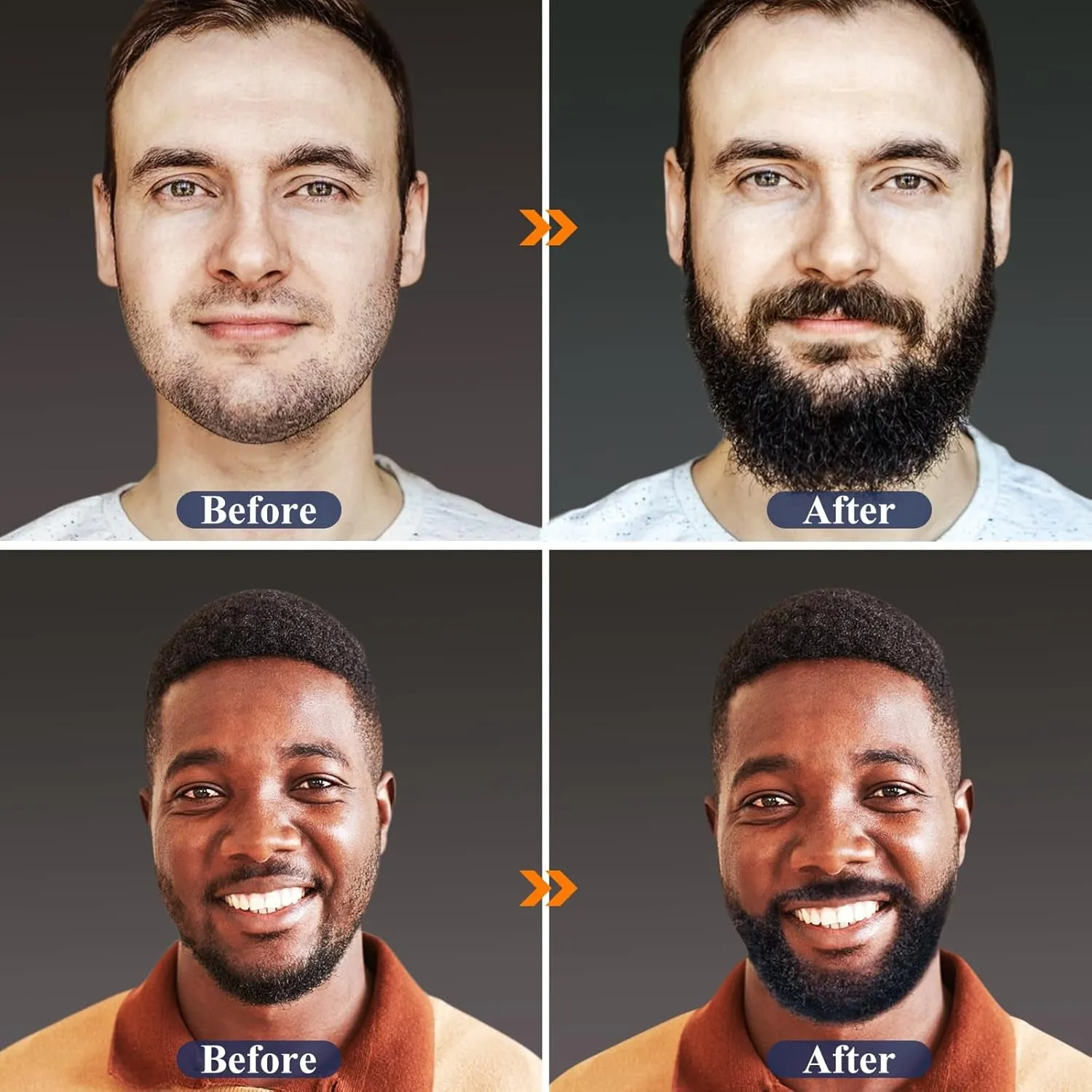 Beard Growth Kit, Beard Kit W/Beard Growth Oil, Balm, Comb, Massager for Spot/Patchy Beard, Gifts for Men Him Boyfriend Husband